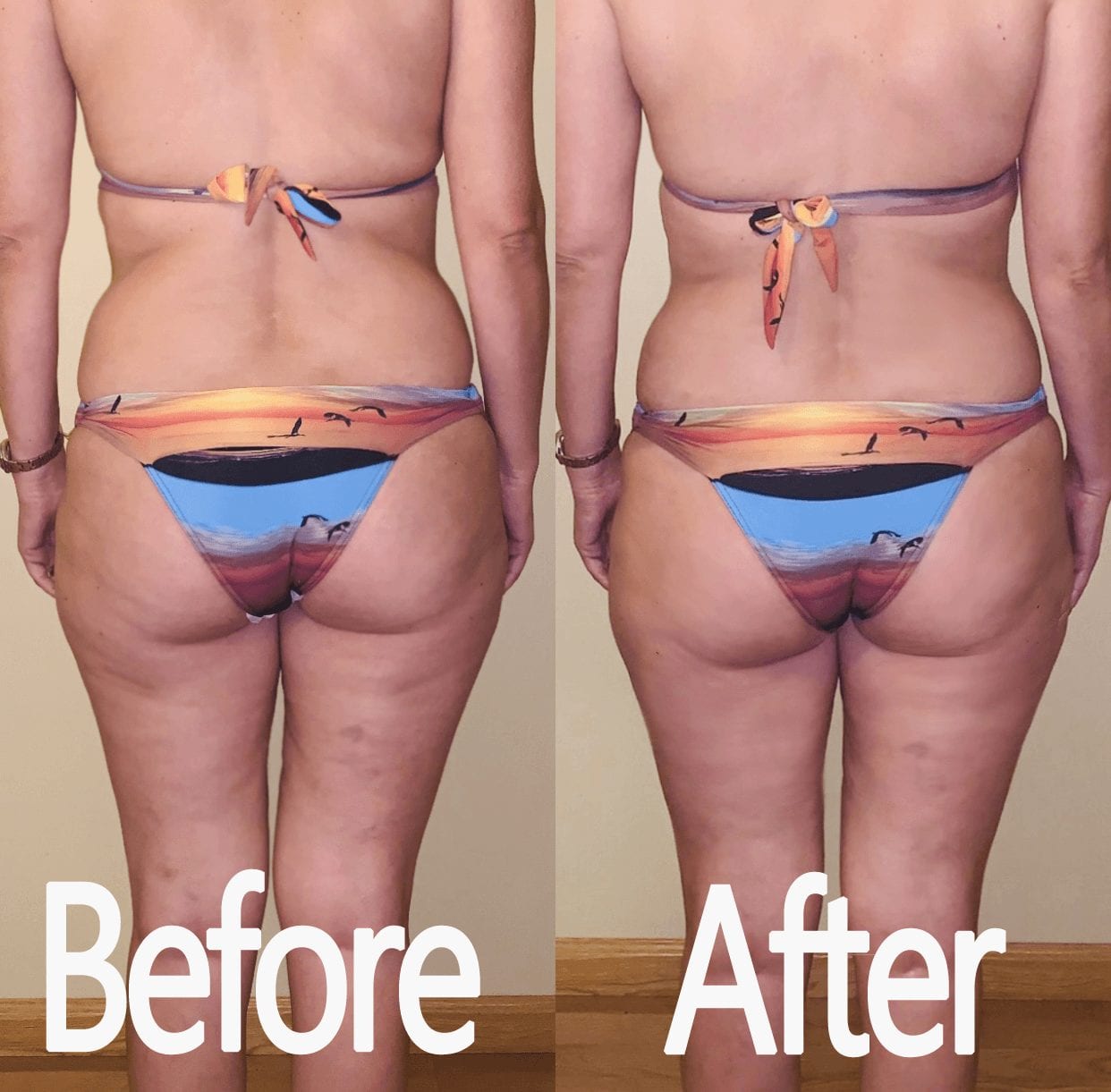 Carolina Pintos Therapy Before And After Results